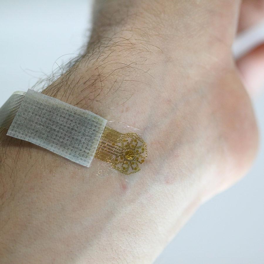 UI researchers create blood tracking tattoo