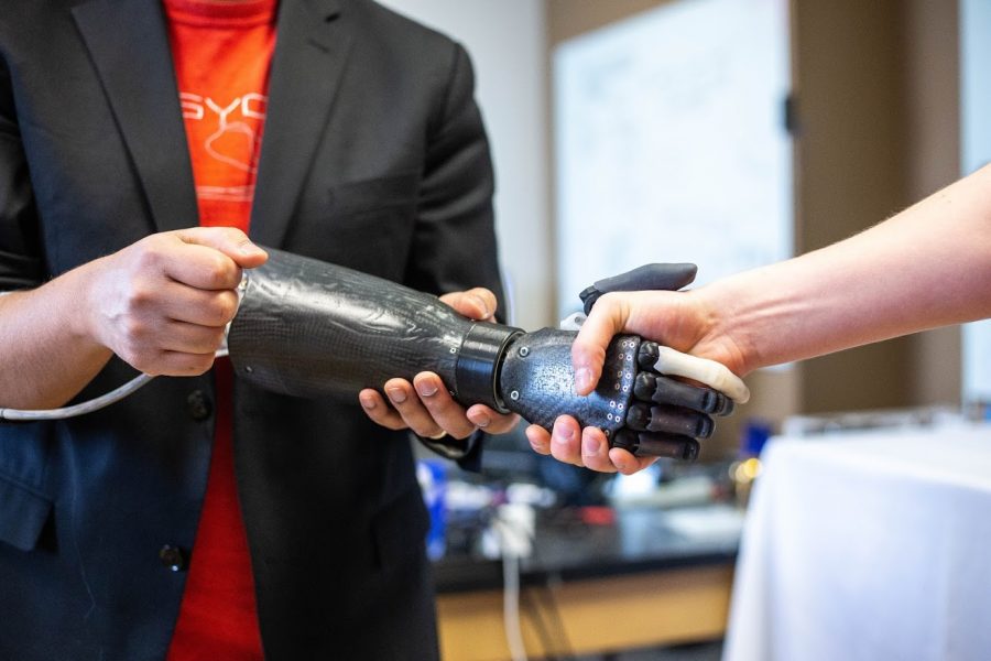 Aadeel Akhtar, founder of PSYONIC, shows the functions of his robotic prosthetic arm. The arm responds to human muscle activity to mimic hand movements.