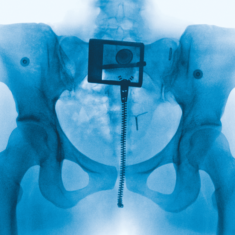 Cover art for Lorde's album, “Virgin,” released on June 27.