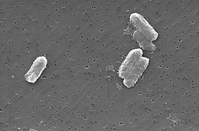 A scanning electron microscope showing Citrobacter freundii, a bacteria which produces NDM and can become resistant to carbapenems, a first-line antibiotic. The Centers for Disease Control and Prevention detected an uptick in infections by NDM-CRE bacteria from 2019-2023.